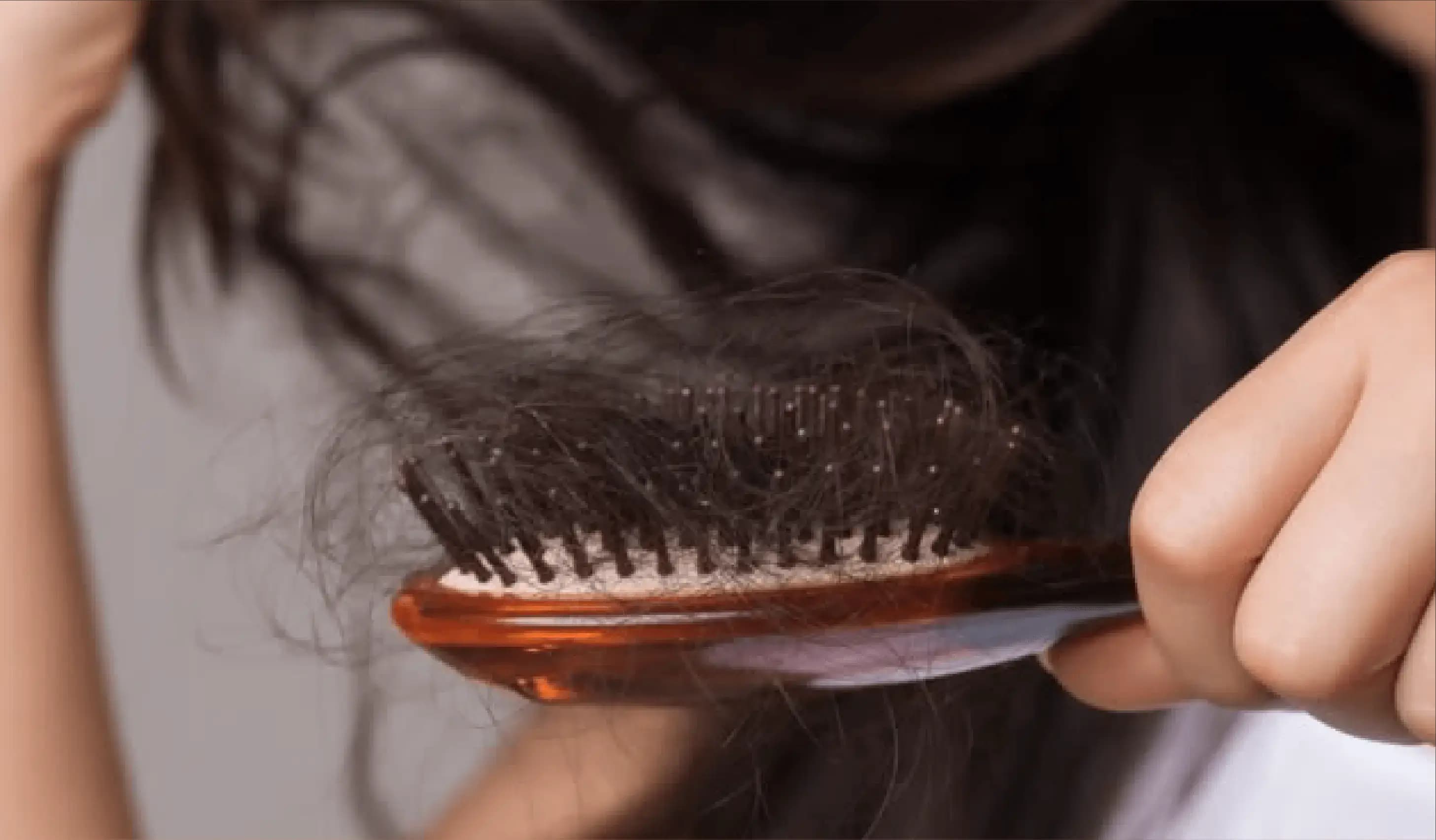 Postpartum Hair Loss
